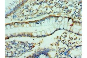Immunohistochemistry of paraffin-embedded human small intestine tissue using ABIN7147898 at dilution of 1:100 (Claudin 2 anticorps  (AA 30-230))