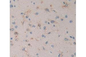 Used in DAB staining on fromalin fixed paraffin- embedded brain tissue (RGS anticorps  (AA 1-296))