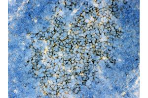 Anti- SQSTM1 Picoband antibody,IHC(F) IHC(F): Rat Spleen Tissue