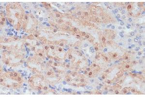 Immunohistochemistry of paraffin-embedded Mouse kidney using CLDN17 Polyclonal Antibody at dilution of 1:100 (40x lens). (Claudin 17 anticorps)