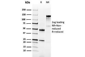 SDS-PAGE Analysis Purified NKX3. (NKX3-1 anticorps  (AA 92-224))
