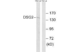 Western blot analysis of extracts from HeLa cells, using DSG2 antibody.