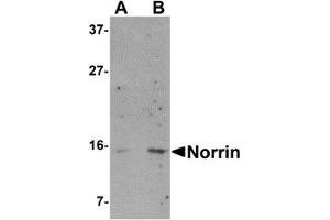 Western Blotting (WB) image for anti-Norrie Disease (Pseudoglioma) (NDP) (N-Term) antibody (ABIN1031487) (Norrie Disease (Pseudoglioma) anticorps  (N-Term))