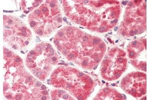 anti-Carboxypeptidase, Vitellogenic-Like (CPVL) (Middle Region) antibody