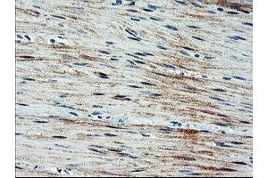 Immunohistochemical staining of paraffin-embedded Human colon tissue using anti-ARL11 mouse monoclonal antibody. (ARL11 anticorps)