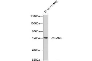 Western blot analysis of extracts of Mouse kidney using ZSCAN4C Polyclonal Antibody at dilution of 1:1000. (ZSCAN4C anticorps)