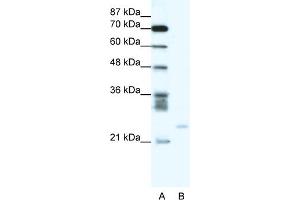 WB Suggested Anti-BCL2A1 Antibody Titration:  0. (BCL2A1 anticorps  (C-Term))