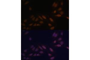 Immunofluorescence analysis of U-2 OS cells using EED Polyclonal Antibody (ABIN6133691, ABIN6139940, ABIN6139943 and ABIN6216521) at dilution of 1:100 (40x lens). (EED anticorps  (AA 1-100))