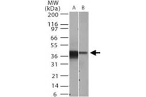 Western blot analysis of NFKBIA. (NFKBIA anticorps  (AA 32-291))