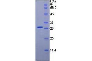 SDS-PAGE analysis of Mouse HGF Protein. (HGF Protéine)