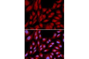Immunofluorescence analysis of U2OS cells using BAG1 antibody (ABIN5970457). (BAG1 anticorps)