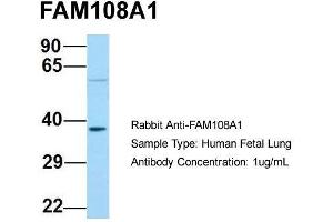 Host: Rabbit  Target Name: FAM108A1  Sample Tissue: Human Fetal Lung  Antibody Dilution: 1. (ABHD17A anticorps  (C-Term))