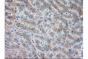 Immunohistochemical staining of paraffin-embedded liver tissue using anti-TRPM4mouse monoclonal antibody. (TRPM4 anticorps)