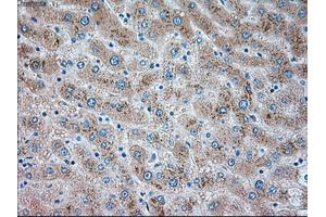 Immunohistochemical staining of paraffin-embedded liver tissue using anti-TRPM4mouse monoclonal antibody.