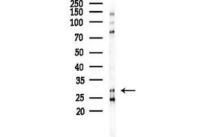 Western blot analysis of lysates from LoVo cells(heat-shock,45 min treatment), using MRPL10 Antibody at 1/1000 dilution.