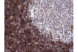 Immunohistochemistry (IHC) image for anti-T-cell surface glycoprotein CD1c (CD1C) antibody (ABIN2670659) (CD1c anticorps)