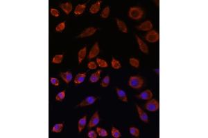 Immunofluorescence analysis of L929 cells using HPS4 antibody (ABIN7267623) at dilution of 1:100.