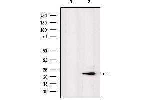 anti-Protein Phosphatase 1, Regulatory (Inhibitor) Subunit 2 Pseudogene 3 (PPP1R2P3) antibody