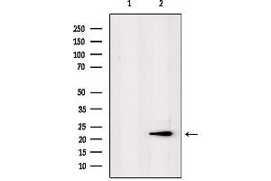 Western blot analysis of extracts from mouse lung, using PPP1R2P3 Antibody. (PPP1R2P3 anticorps)