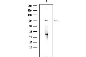 Western blot analysis of lysates from EC304 cells(heat-shock treatment), using SEMC Antibody at 1/1000 dilution.