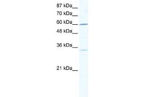 Human Jurkat; WB Suggested Anti-ZNF668 Antibody Titration: 0. (ZNF668 anticorps  (N-Term))