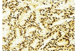 ABIN6276976 at 1/100 staining Human lung tissue by IHC-P. (PSMD10 anticorps  (C-Term))