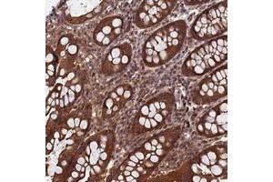Immunohistochemical staining of human colon with CCDC125 polyclonal antibody  shows strong cytoplasmic positivity in glandular cells. (CCDC125 anticorps)