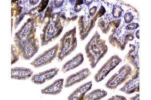 IHC analysis of PPCS using anti-PPCS antibody (ABIN6719631). (PPCS anticorps)