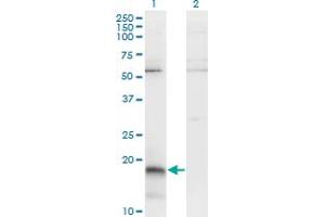 Western Blot analysis of PAEP expression in transfected 293T cell line by PAEP monoclonal antibody (M01), clone 6G2. (PAEP anticorps  (AA 53-162))