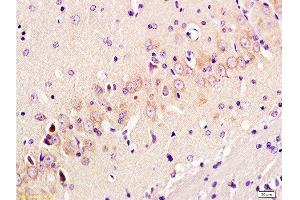 Formalin-fixed and paraffin embedded: rat brain tissue labeled with Anti-GAP-43 Polyclonal Antibody, Unconjugated  at 1:300 followed by conjugation to the secondary antibody and DAB staining (GAP43 anticorps  (AA 9-100))