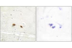 Immunohistochemistry analysis of paraffin-embedded human brain tissue, using EGR3 Antibody. (EGR3 anticorps  (AA 338-387))
