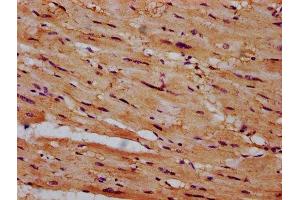 IHC image of ABIN7149034 diluted at 1:600 and staining in paraffin-embedded human heart tissue performed on a Leica BondTM system. (CSAD anticorps  (AA 344-493))