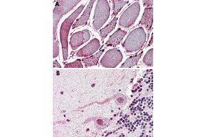 Immunohistochemical staining of formalin-fixed, paraffin-embedded human skeletal muscle (A) and human brain (B), cerebellum tissue after heat-induced antigen retrieval. (NEK7 anticorps  (N-Term))