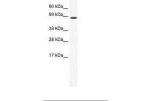 Image no. 1 for anti-TATA Box Binding Protein (TBP)-Associated Factor, RNA Polymerase I, B, 63kDa (TAF1B) (C-Term) antibody (ABIN202789)