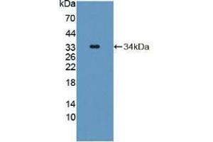 Western blot analysis of recombinant Mouse TAT. (TAT anticorps  (AA 190-454))