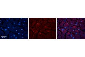 Rabbit Anti-MBD1 Antibody   Formalin Fixed Paraffin Embedded Tissue: Human heart Tissue Observed Staining: Cytoplasmic Primary Antibody Concentration: 1:100 Other Working Concentrations: 1:600 Secondary Antibody: Donkey anti-Rabbit-Cy3 Secondary Antibody Concentration: 1:200 Magnification: 20X Exposure Time: 0.