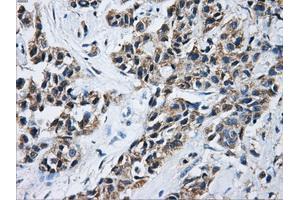 Immunohistochemical staining of paraffin-embedded Kidney tissue using anti-ACO2mouse monoclonal antibody. (ACO2 anticorps)