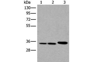 Western blot analysis of A549 Hela and K562 cell lysates using RPF2 Polyclonal Antibody at dilution of 1:400 (RPF2 anticorps)