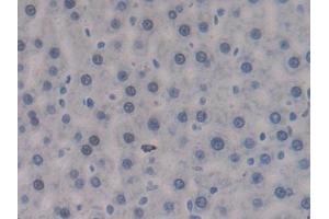 DAB staining on IHC-P; Samples: Rat Liver Tissue