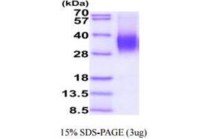 SDS-PAGE (SDS) image for CD48 (CD48) (AA 27-220) protein (His tag) (ABIN7281272)