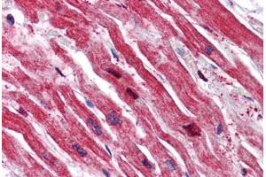 Human Heart: Formalin-Fixed, Paraffin-Embedded (FFPE) (SRPX anticorps  (N-Term))