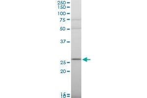 RPS9 polyclonal antibody (A01), Lot # 051207JC01.