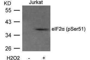 Western blot analysis of extracts from Jurkat cells untreated or treated with H2O2 using eIF2a(Phospho-Ser51) Antibody. (EIF2S1 anticorps  (pSer51))