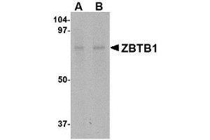 Image no. 1 for anti-Zinc Finger and BTB Domain Containing 1 (ZBTB1) (Internal Region) antibody (ABIN341710) (ZBTB1 anticorps  (Internal Region))