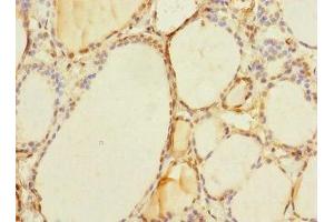 Immunohistochemistry of paraffin-embedded human thyroid tissue using ABIN7171504 at dilution of 1:100