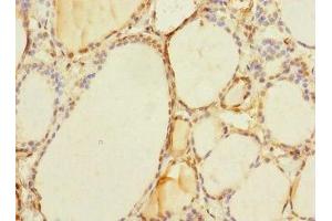 Immunohistochemistry of paraffin-embedded human thyroid tissue using ABIN7171504 at dilution of 1:100 (TAPBPL anticorps  (AA 201-468))