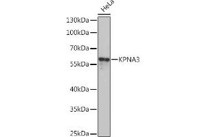 Western blot analysis of extracts of HeLa cells, using KPN Rabbit pAb  at 1:1000 dilution. (KPNA3 anticorps  (AA 1-210))