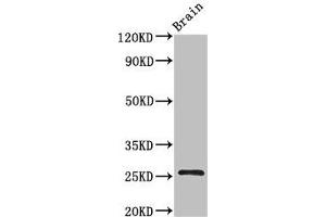 Western Blot Positive WB detected in: Mouse brain tissue All lanes: BTG4 antibody at 3 μg/mL Secondary Goat polyclonal to rabbit IgG at 1/50000 dilution Predicted band size: 26, 25 kDa Observed band size: 26 kDa (BTG4 anticorps  (AA 1-206))