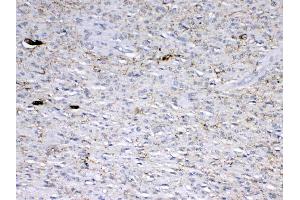 IHC analysis of GAD65 using anti-GAD65 antibody .