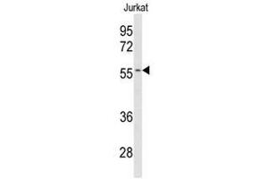 Image no. 1 for anti-Cytochrome P450, Family 2, Subfamily C, Polypeptide 19 (CYP2C19) (Middle Region) antibody (ABIN452898)